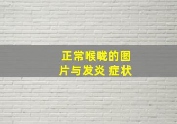 正常喉咙的图片与发炎 症状